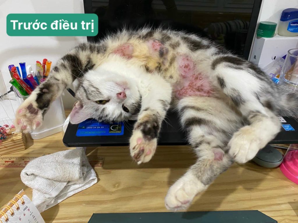 Sau khi thăm khám, bác sĩ kết luận bạn Bối bị viêm da cơ địa